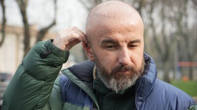 Saç ekerken kulak zarına zarar geldi!