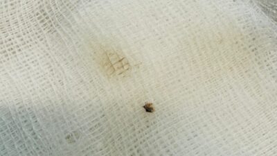 Hastaneye gitti kene şokuyla karşılaştı!